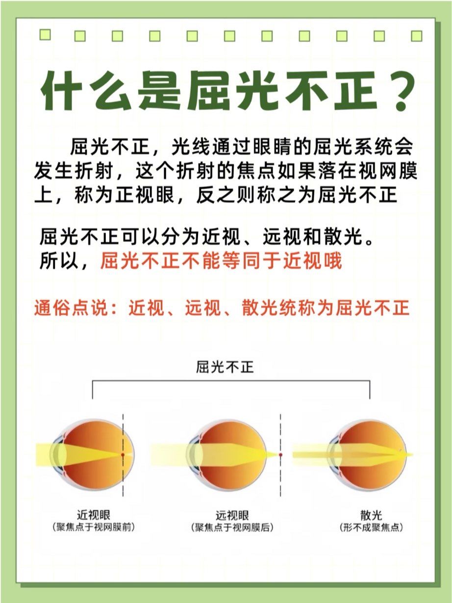 经常会听到"屈光不正"的说法,那这到底是什么意思呢❓屈光不正就是