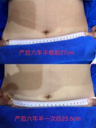 -蓝丝带产后恢复中心·催乳·通乳(渝北汽博店)