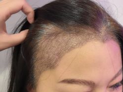 -熙朵美学植发·连锁品牌