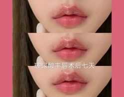 -上海漾颜医疗美容