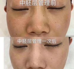 -美肤盾祛痘·问题肌头疗管理中心