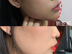 -团圆口腔·种植中心(锦江院区)