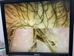 -章光101防脱养发荟