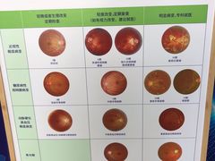 -宝岛眼镜(福州宝龙二店)