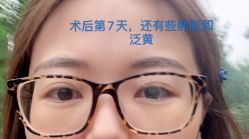 -八大处整形