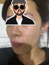 -HEYAN荷妍专业脱毛连锁机构