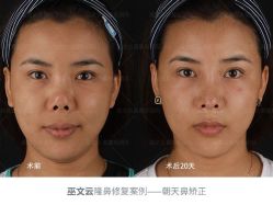 -北京米扬丽格医疗美容·联合丽格鼻整形中心