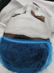 -悟空祛痘·诺奖技术专业店