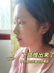 -安徽合肥韩美整形外科医院