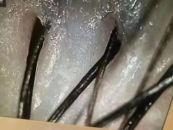 -希梵尔头皮抗衰·科技养发
