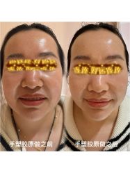 -水仙美肌面部护理美容馆