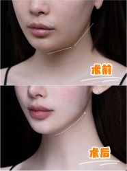 -深圳艺星医疗美容医院