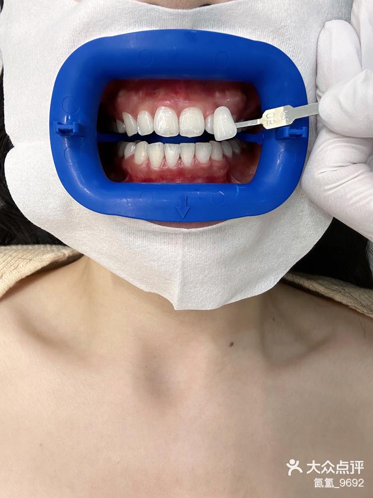 营口口腔天花板