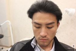 点击看大图 -大麦微针植发丨全国连锁