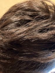 -熙朵美学植发·连锁品牌