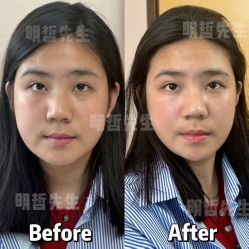 -颜和骨正·明哲式骨相美学整骨