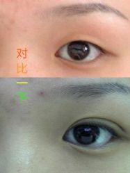 -美莱医学美容医院