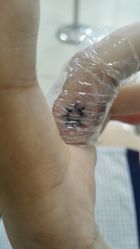 -英刺青 纹身 洗纹身