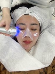 体验后-悟空祛痘·诺奖技术专业店