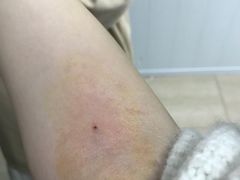 -天津市黄河医院