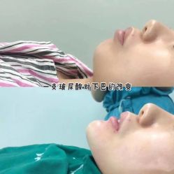 -上海漾颜医疗美容