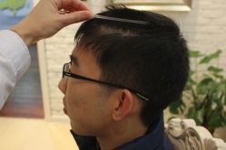 点击看大图 -大麦微针植发丨全国连锁