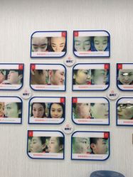 -悟空祛痘·诺奖技术专业店