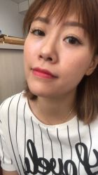体验后-坤如玛丽·医疗美容中心