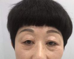 -天津健丽·去眼袋医疗美容机构