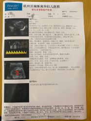 -杭州贝瑞斯美华妇儿医院·早孕·产检·儿科