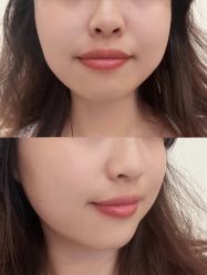 -芙贝佳禾·痘肌管理中心