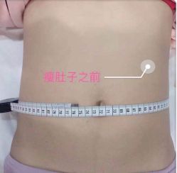 -Lily纤美·科技减脂中心