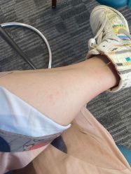 -上海玫瑰医疗美容医院