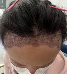 点击看大图 -熙朵美学植发·连锁品牌