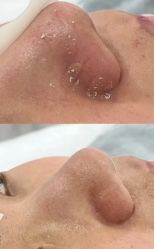 -SKIN79皮肤管理中心