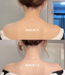 点击看大图 -天津伊美尔医疗整形美容专科医院