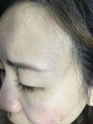-美人痣全国连锁