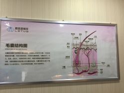 -碧莲盛·不剃发植发