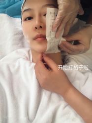 体验前-上海漾颜医疗美容