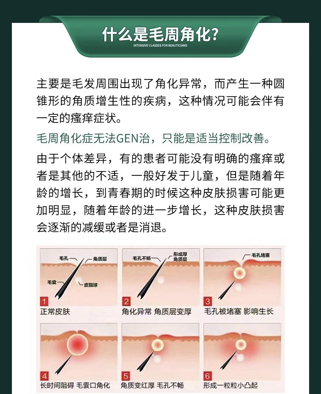 毛周角化