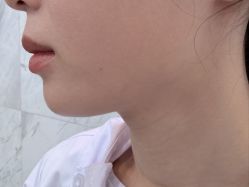 -长沙雅美医疗美容医院