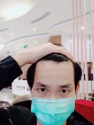 点击看大图 -新生植发·植养护一体