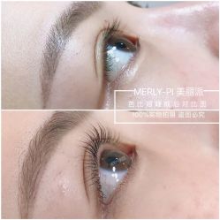 -MLP美丽派·问题肌疗愈中心