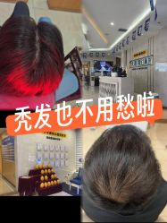 -大麦微针植发全国连锁
