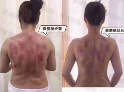 -升艾堂亚健康调理中心