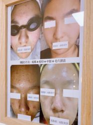 -美肤盾祛痘·问题肌头疗管理中心