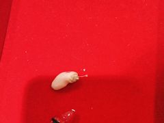 -自然之声助听器·呼吸机(贵定店)