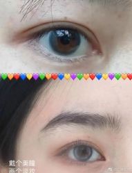 点击看大图 -深圳美莱医疗美容医院