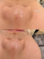 -Flawless skin法思轻奢美肌