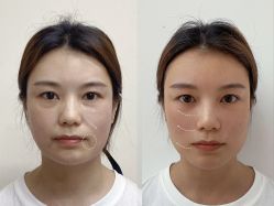 点击看大图 -Yestar重庆艺星医疗美容医院